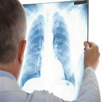 Lung health of Indian children bad: Survey